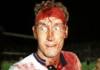 Фотография залитого кровью Терри Бутчера с повязкой на голове дает понимание его мужества на футбольном поле.